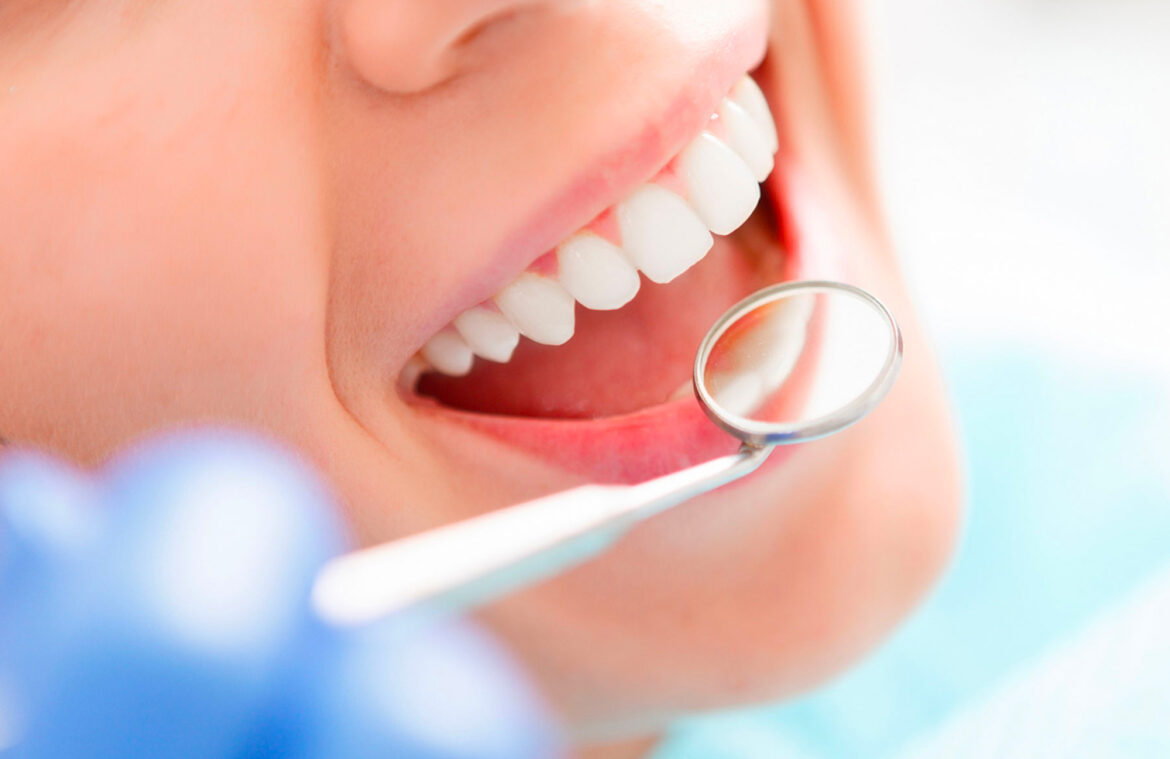 venturi dentista rimini: endodonzia